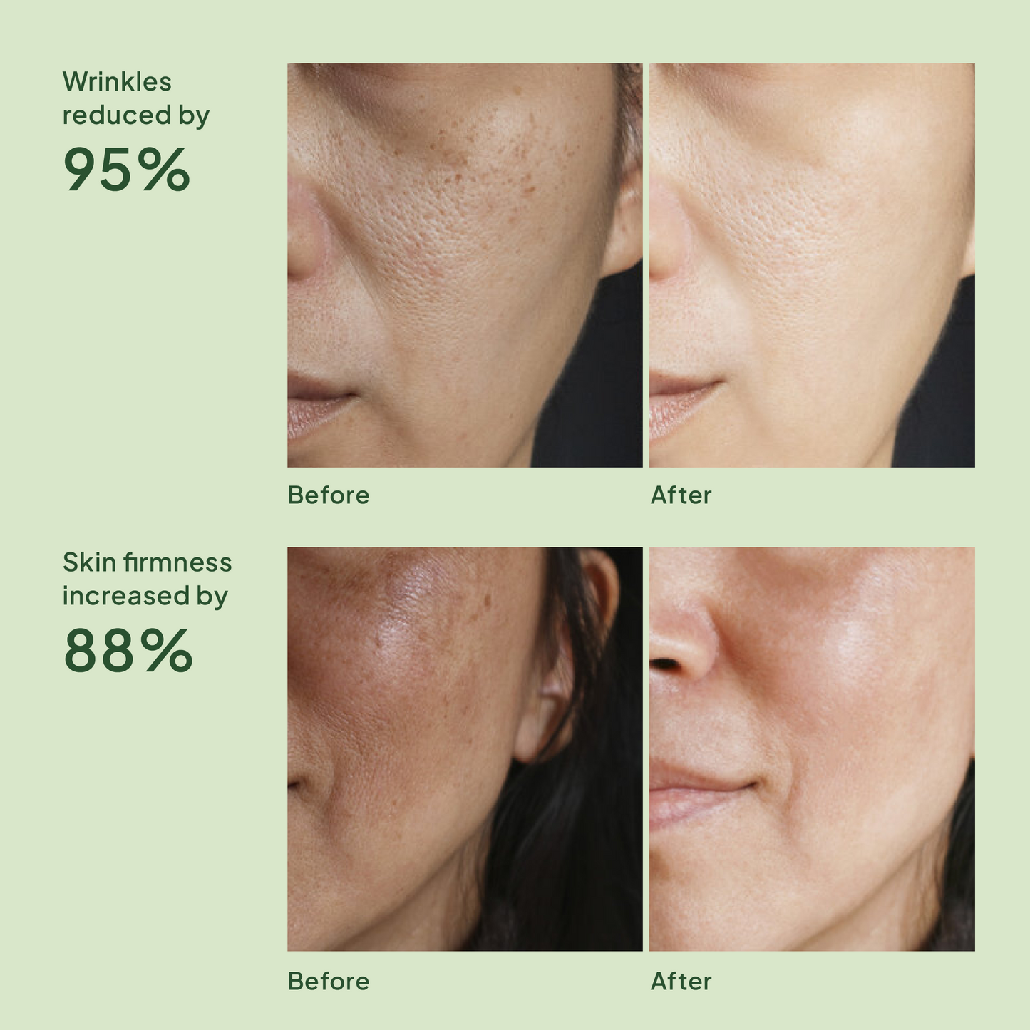 Reverse Skin Aging x 28 bottles