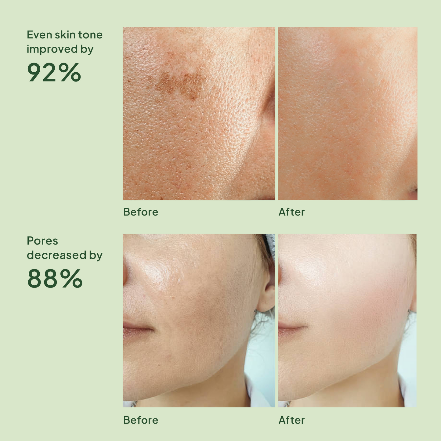 Reverse Skin Aging x 28 bottles