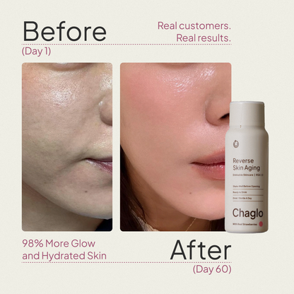 Reverse Skin Aging™: Next Gen Collagen + Antioxidants