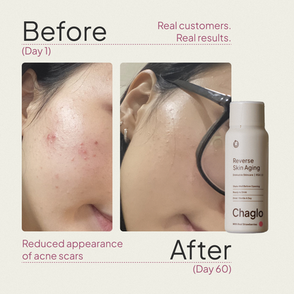 Reverse Skin Aging™: Next Gen Collagen + Antioxidants