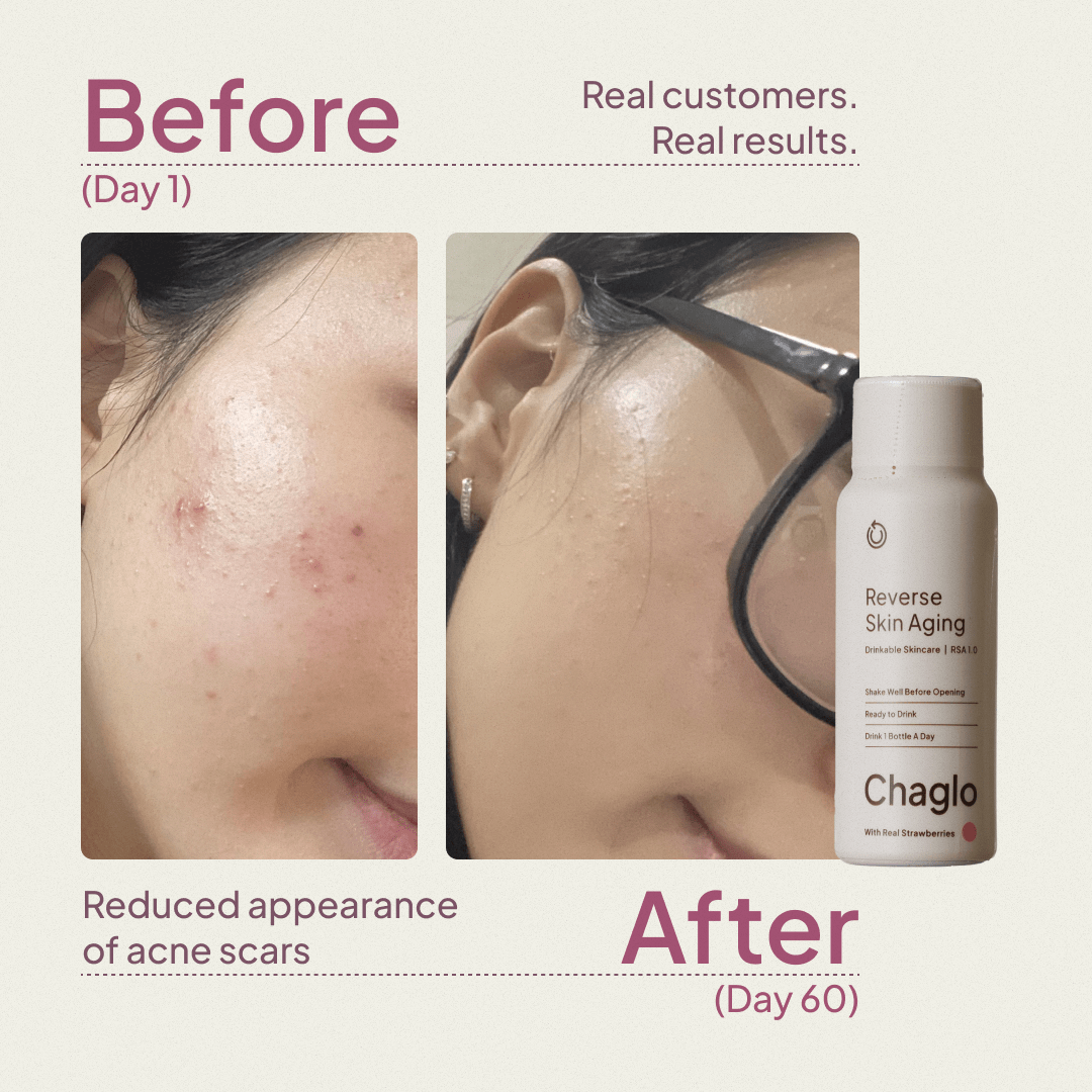 Reverse Skin Aging™: Next Gen Collagen + Antioxidants - Chaglo